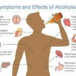 long Term Effects of Alcoholism